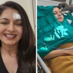 Bhagyashree gets 13 stitches on forehead after getting injured while playing pickleball : Bollywood News