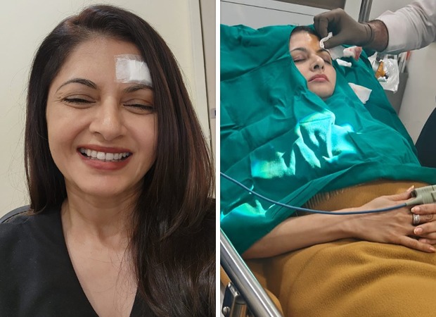 Bhagyashree gets 13 stitches on forehead after getting injured while playing pickleball : Bollywood News